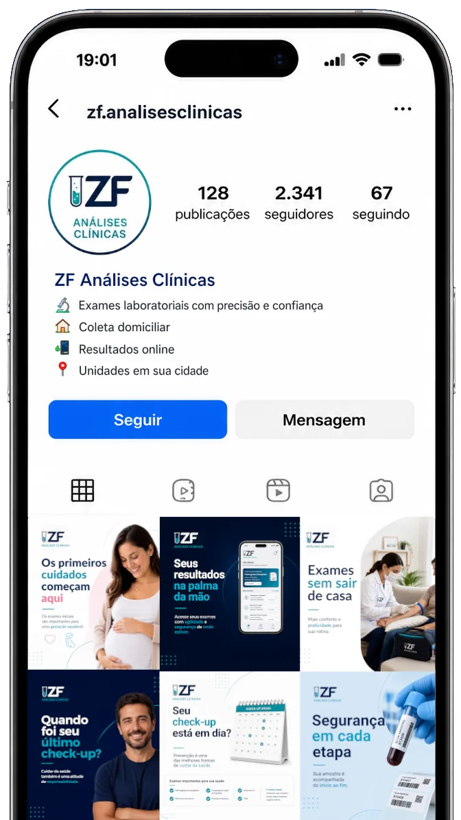Celular exibindo perfil de Instagram de laboratório
