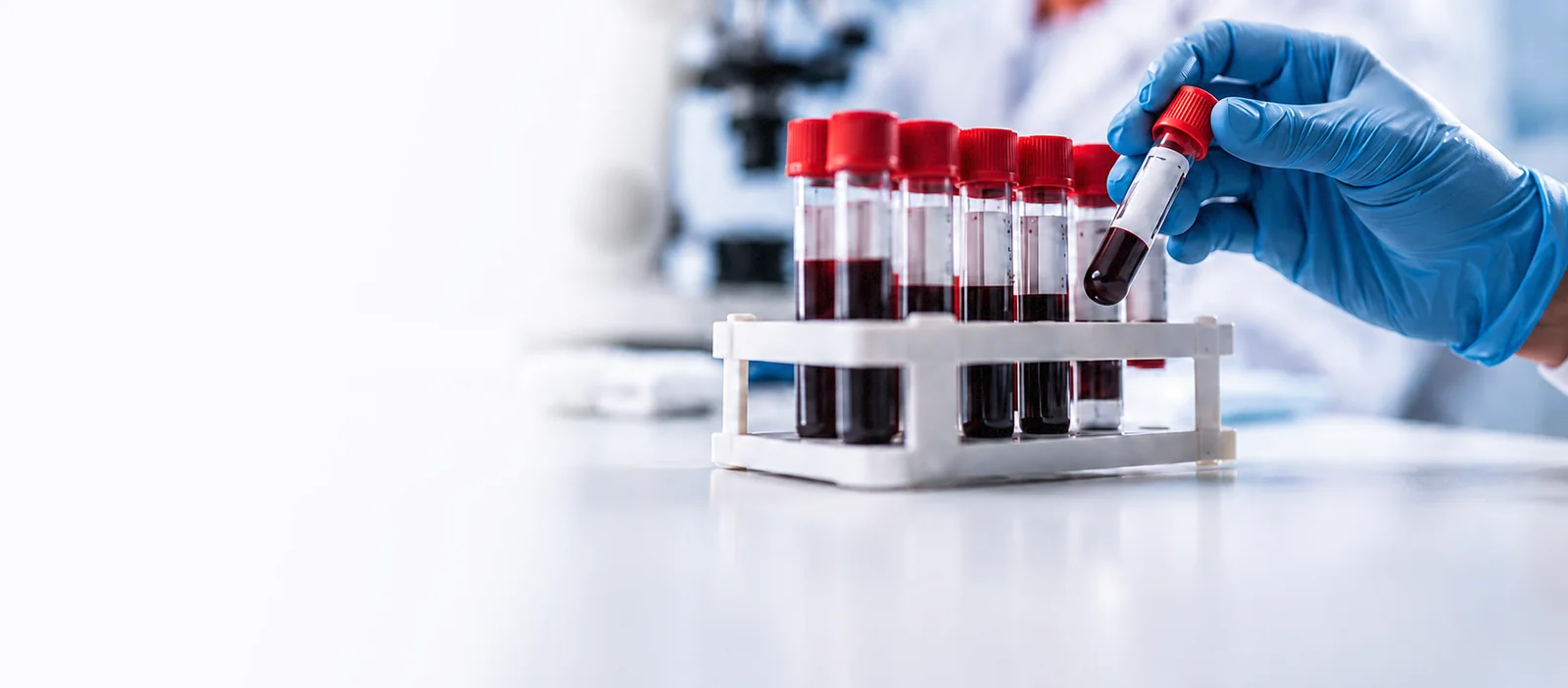 Tubos de coleta com amostras de sangue em ambiente laboratorial